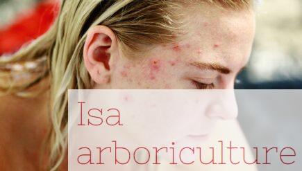 Cómo elegir productos para combatir el acné sin irritar la piel